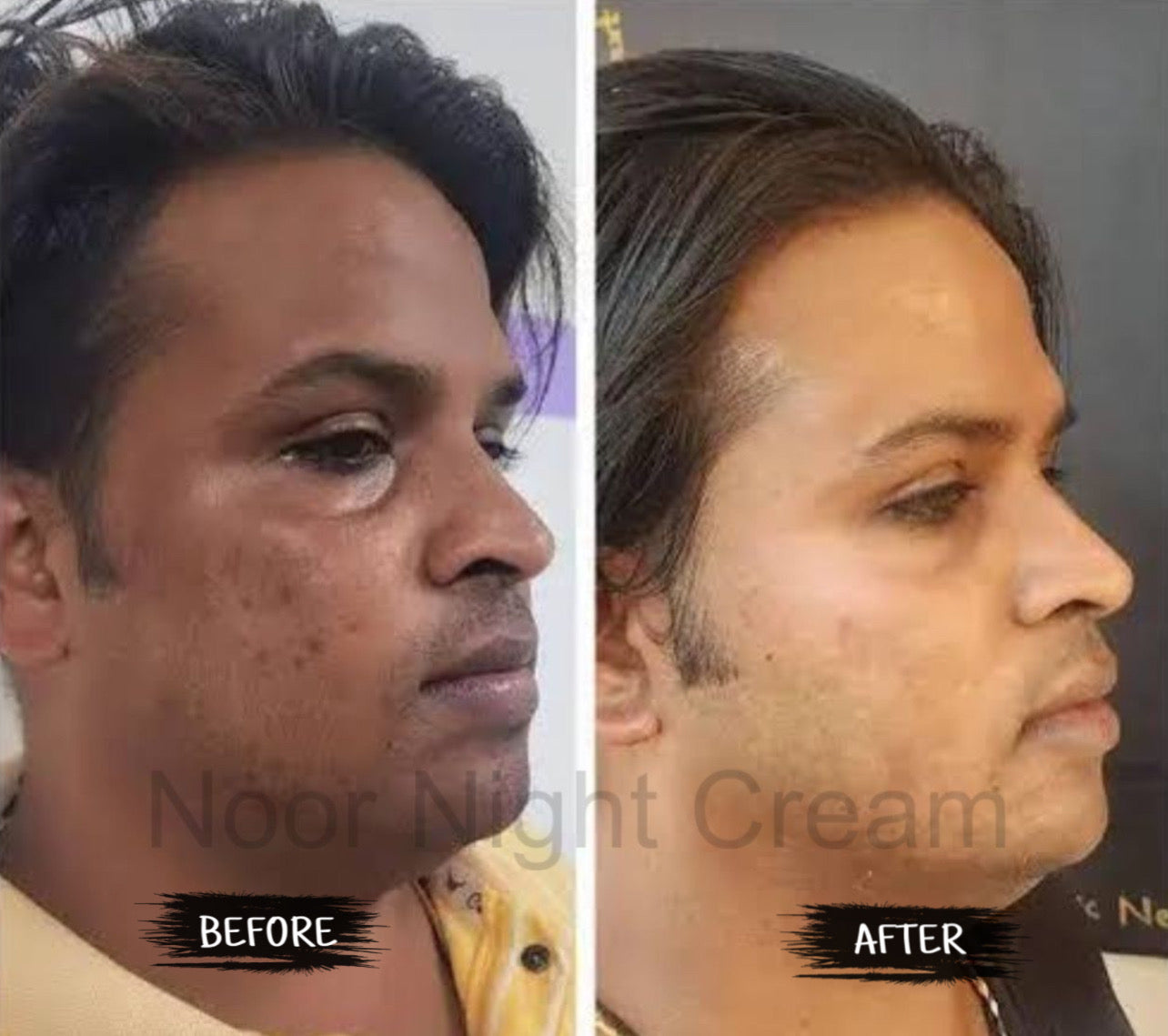NOOR Beauty Combo – Night Cream + Rose Soap | Complete Skin Glow Care (Special Offer ₹1499)